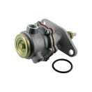 Üzemanyag szivattyú Deutz-Fahr 04175667